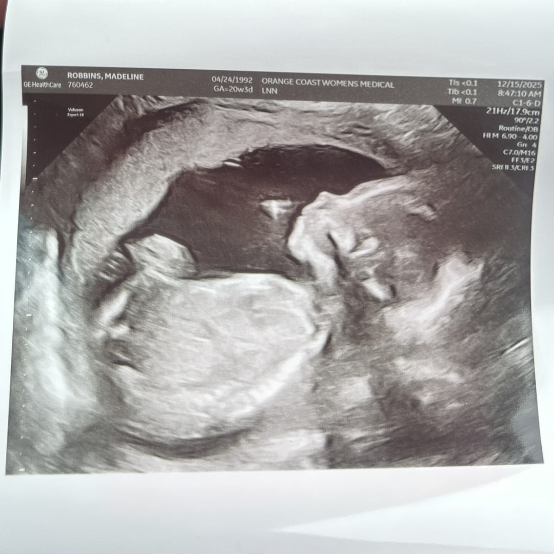 Photo shared by Madeline for their Babylist baby registry.