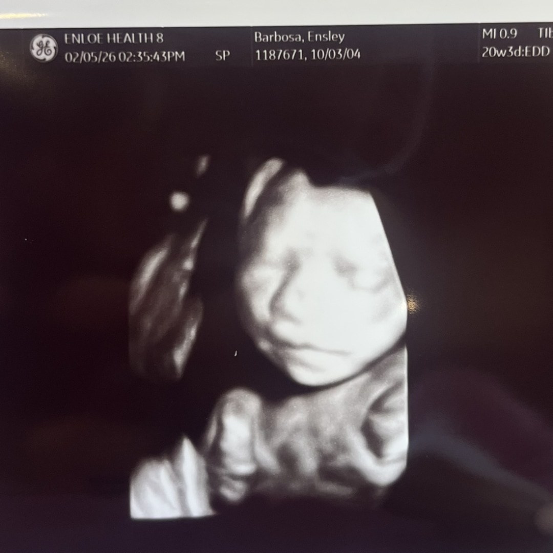 Photo shared by Ensley for their Babylist baby registry.