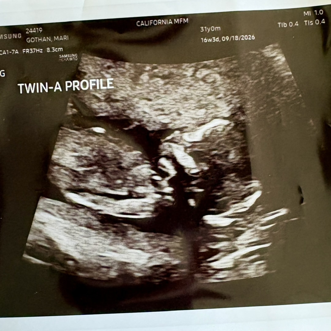 Photo shared by Mari for their Babylist baby registry.