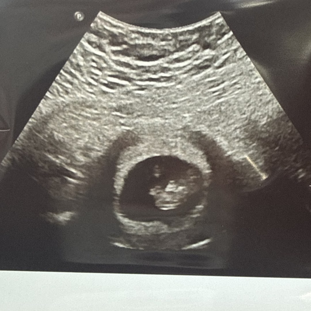 Photo shared by Andrea for their Babylist baby registry.