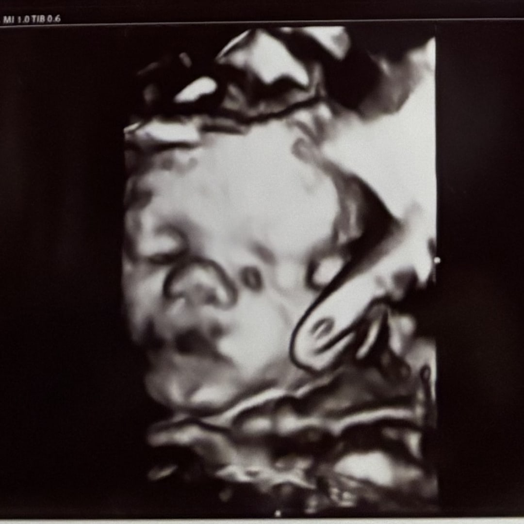 Photo shared by Connor for their Babylist baby registry.