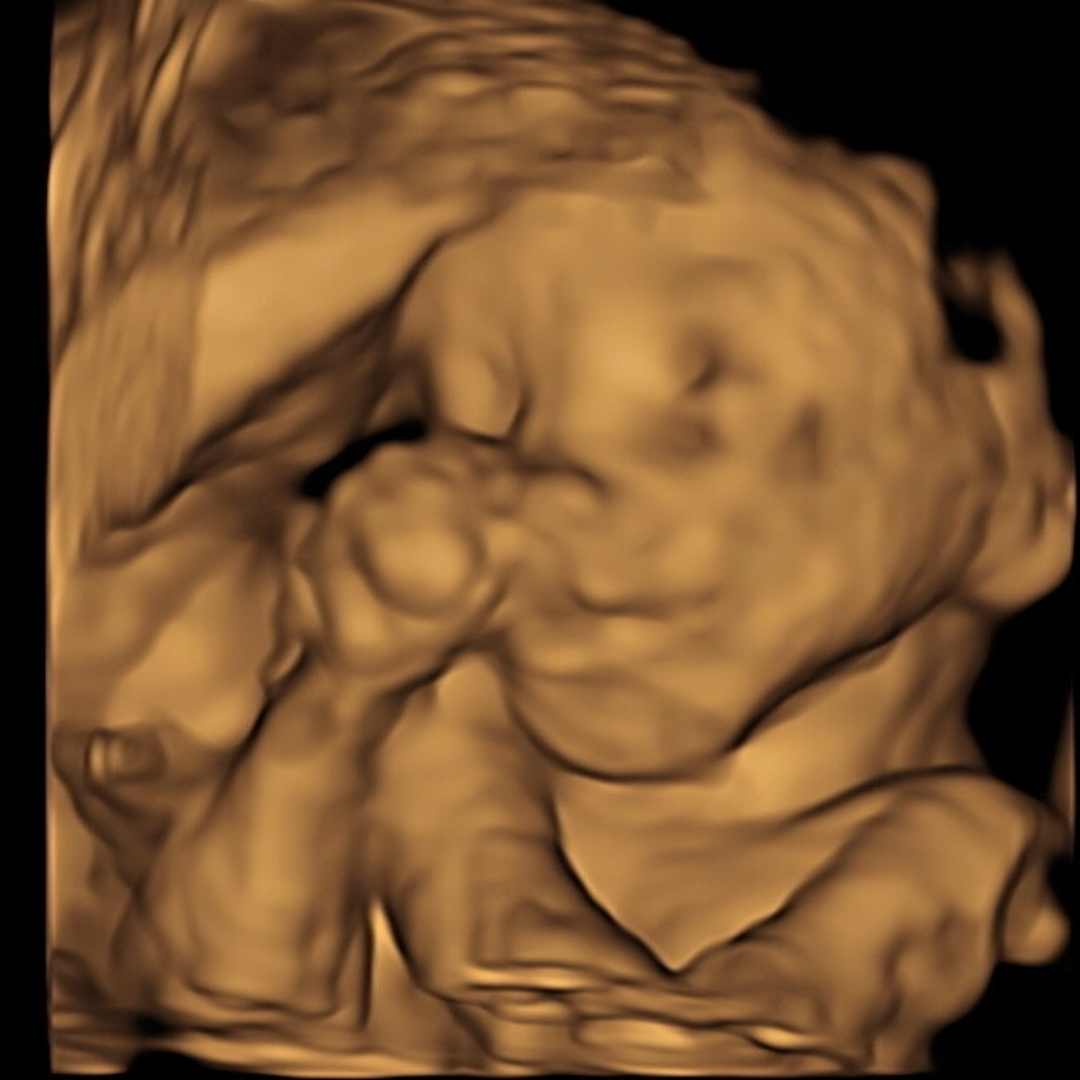 Photo shared by Rose for their Babylist baby registry.