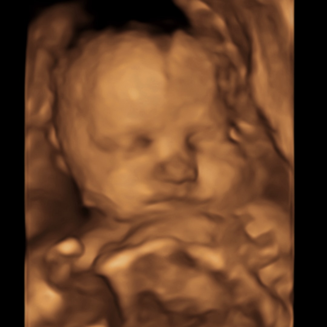 Photo shared by Caroline for their Babylist baby registry.
