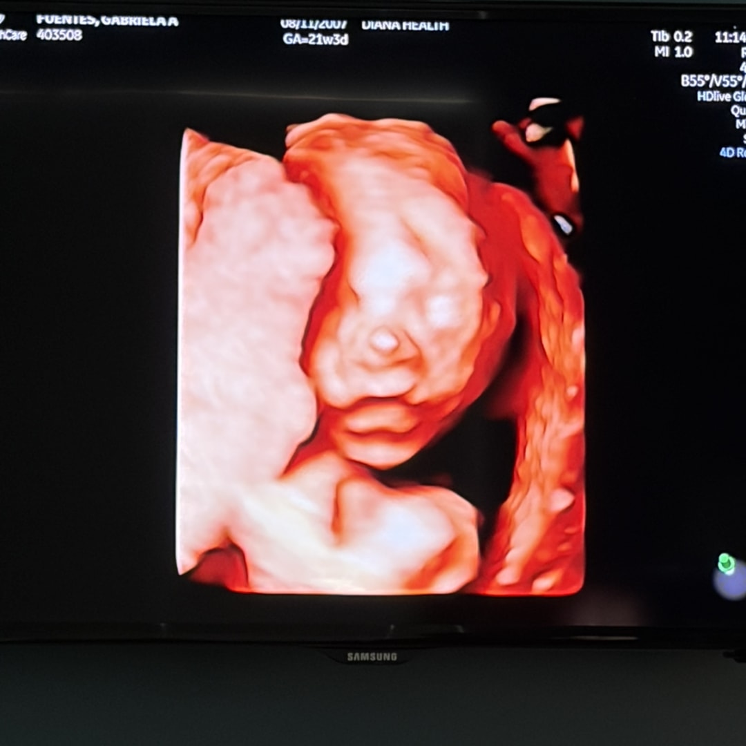 Photo shared by Gabriela for their Babylist baby registry.
