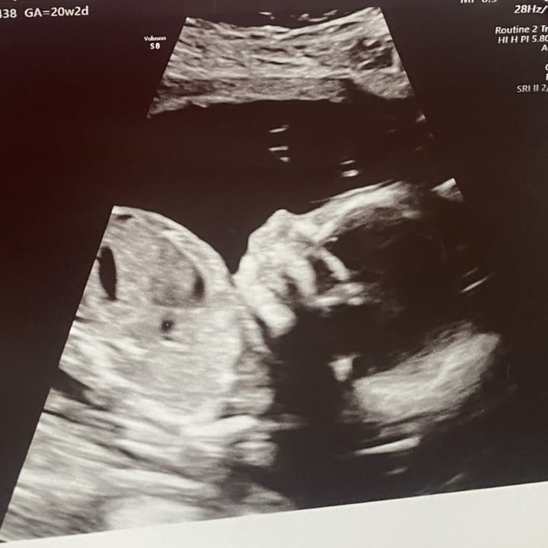 Photo shared by Trinity for their Babylist baby registry.