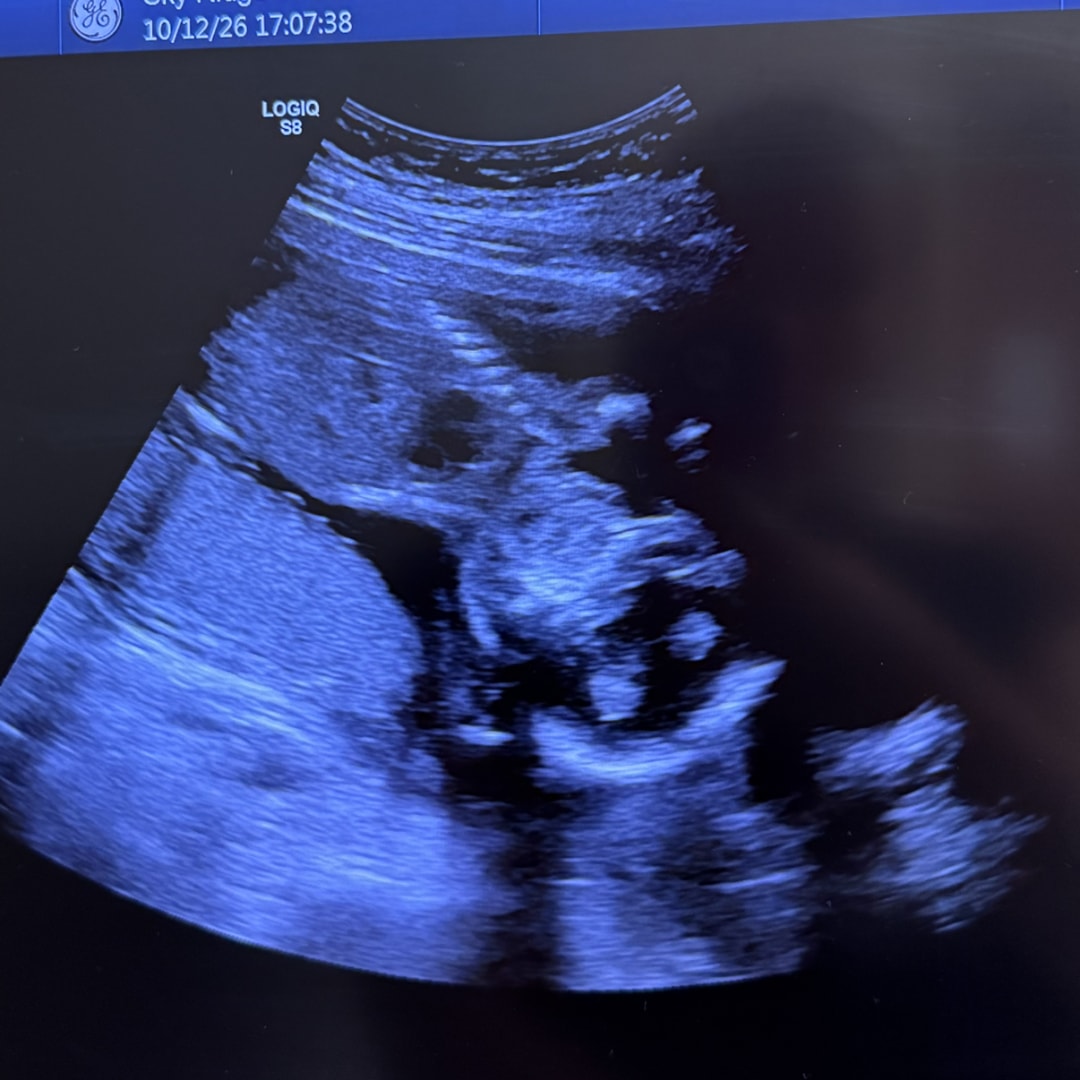 Photo shared by Delaney for their Babylist baby registry.