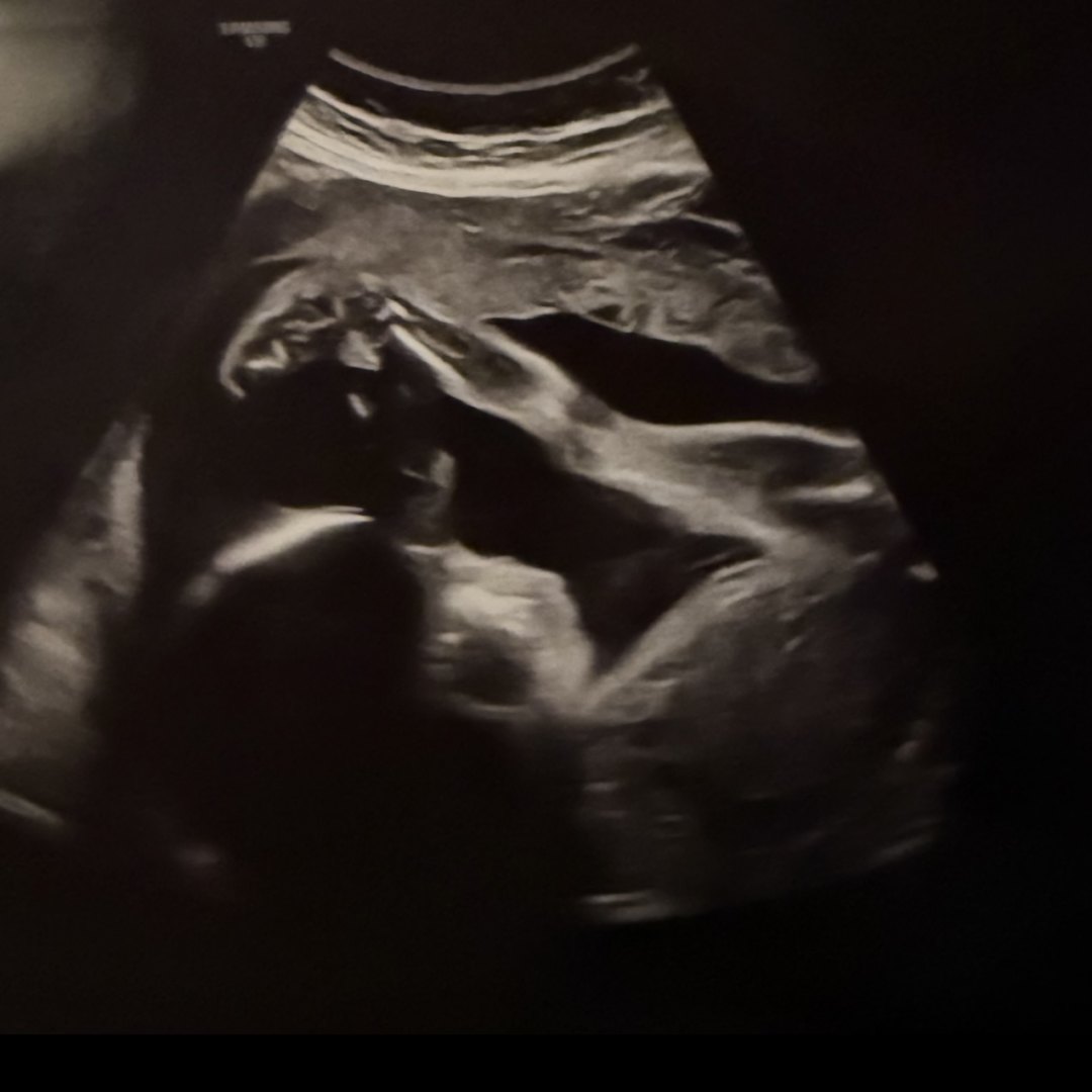 Photo shared by Whitney for their Babylist baby registry.