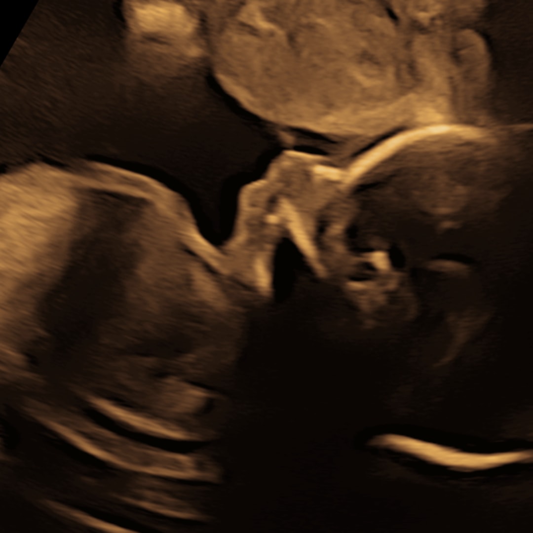 Photo shared by Allison for their Babylist baby registry.