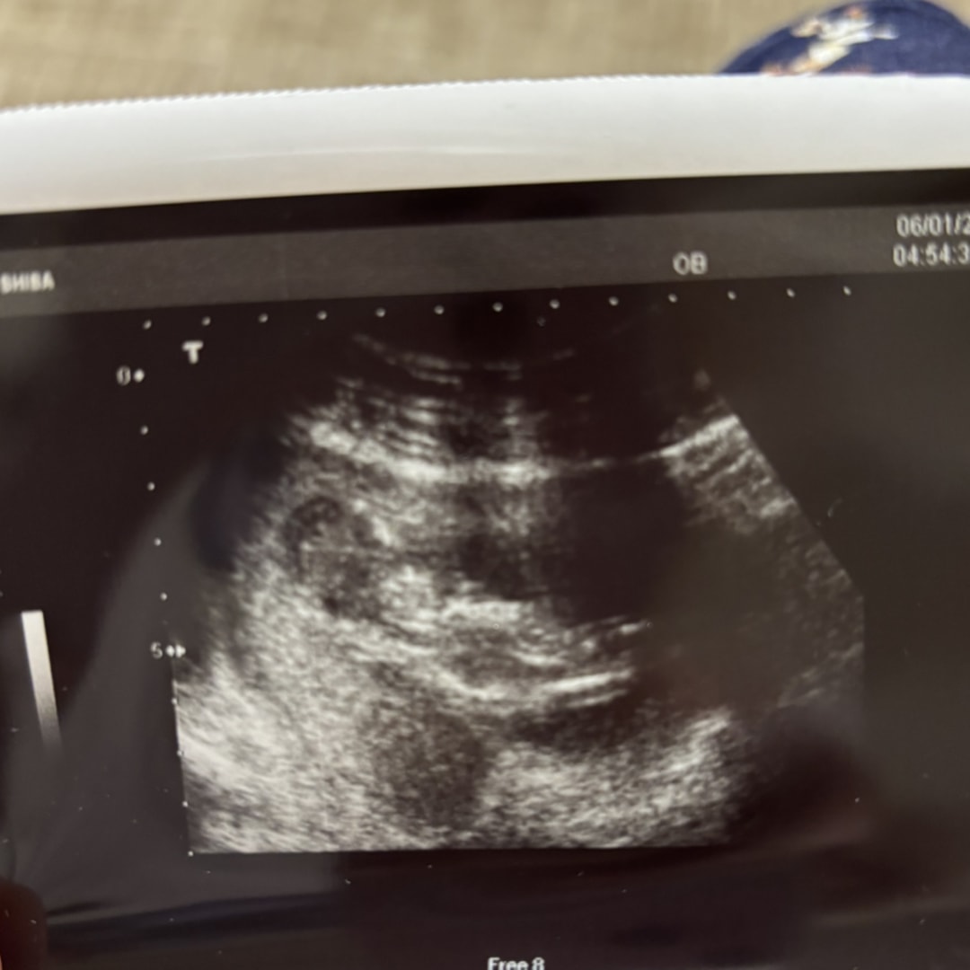 Photo shared by Danielle for their Babylist baby registry.