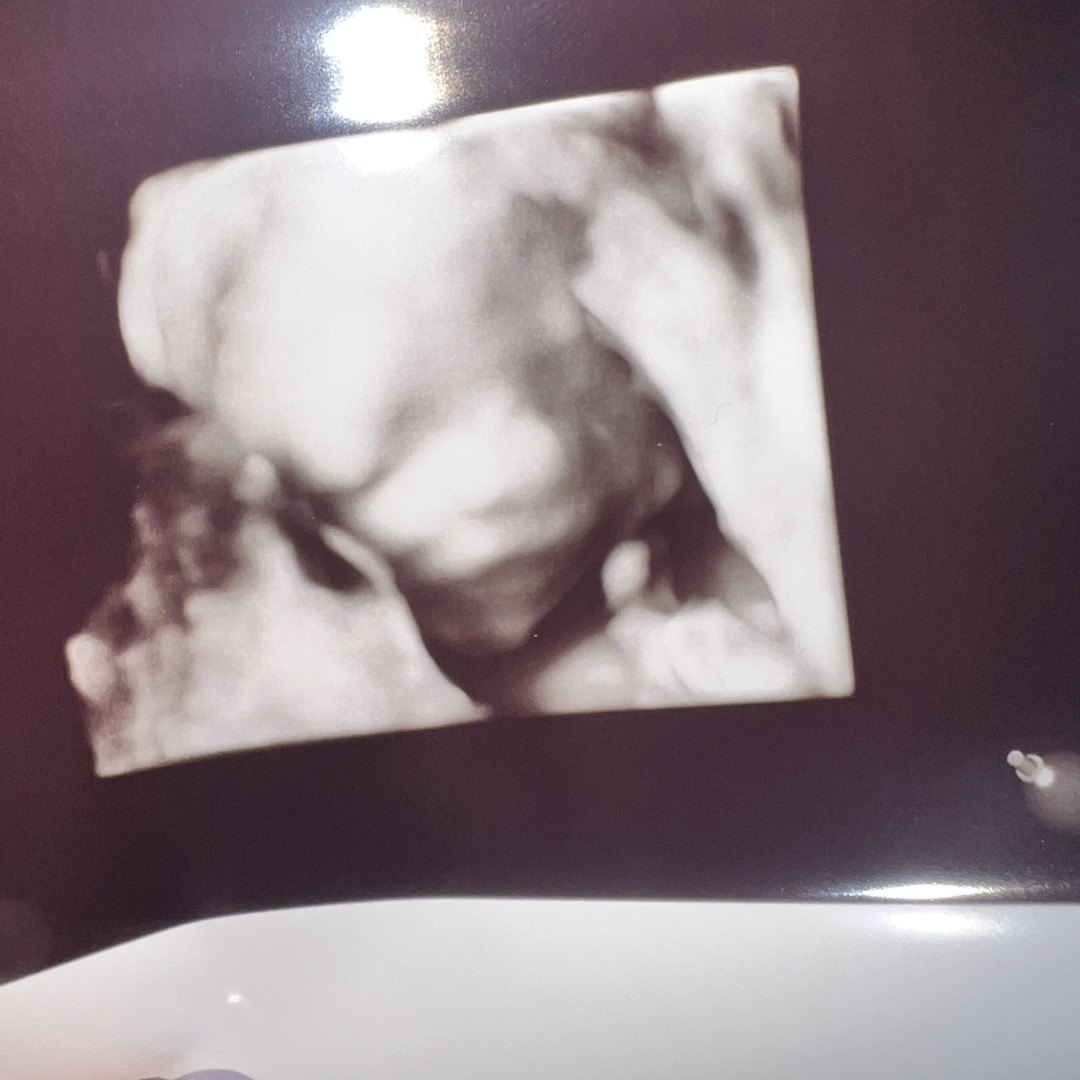 Photo shared by Jessica for their Babylist baby registry.