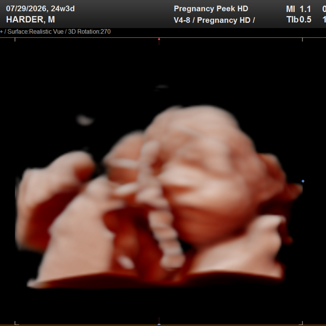Photo shared by Mary-Harbin for their Babylist baby registry.