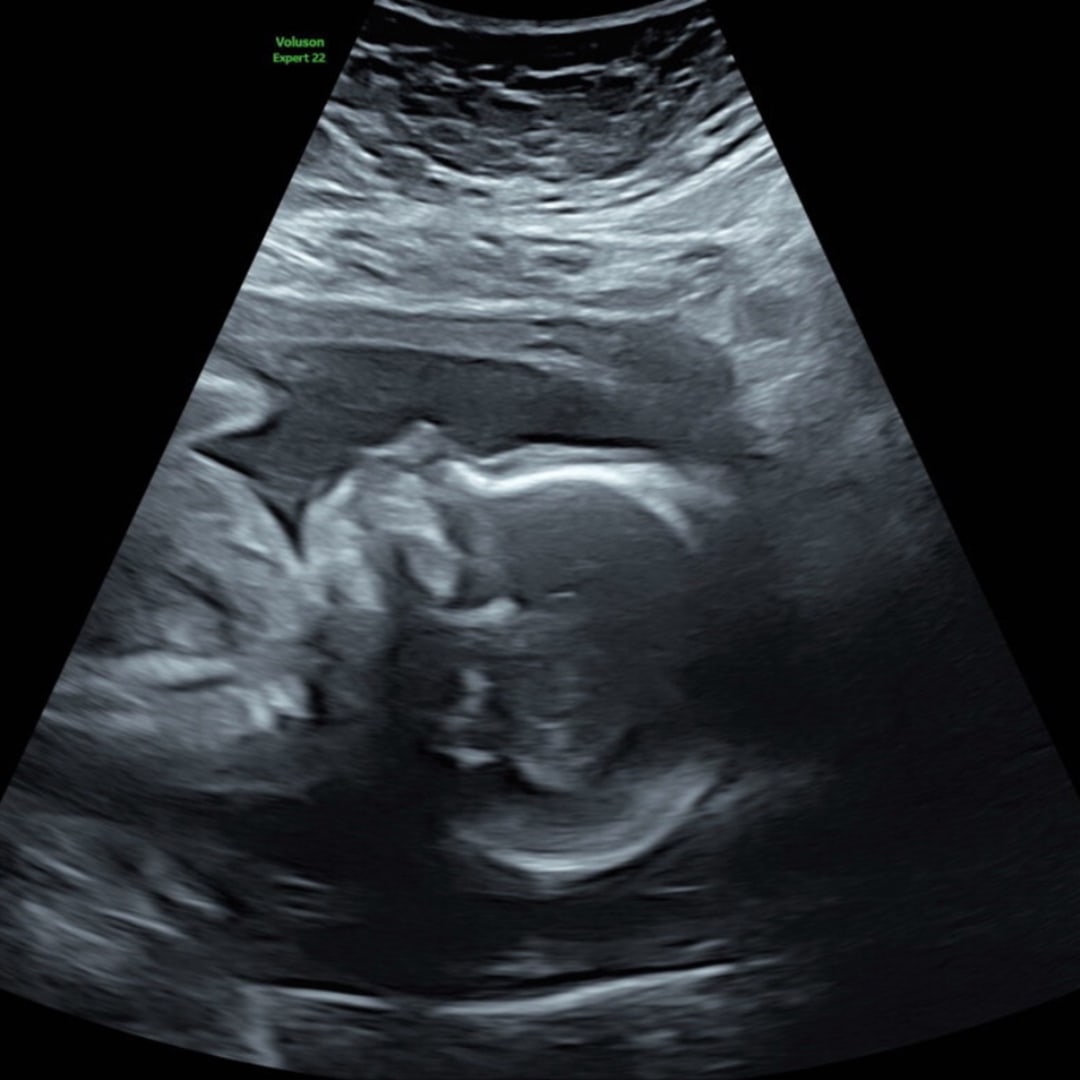 Photo shared by Shelby for their Babylist baby registry.