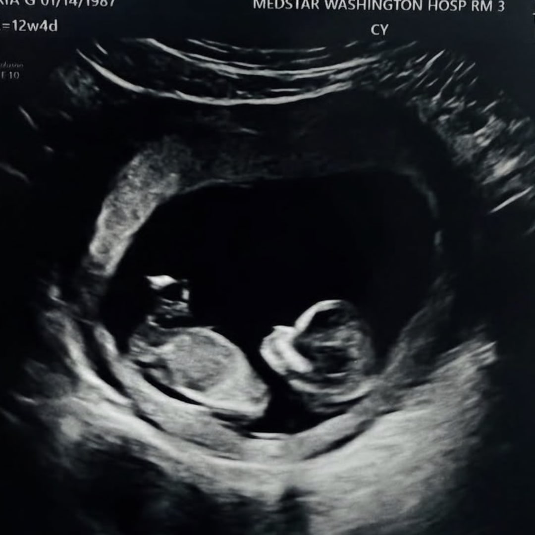 Photo shared by Daria for their Babylist baby registry.