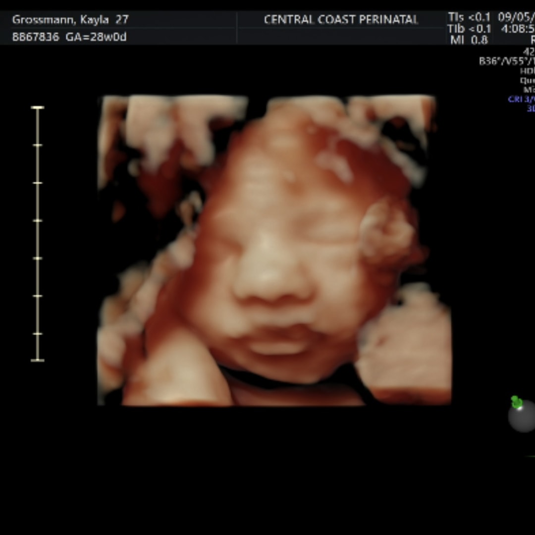 Photo shared by Kayla for their Babylist baby registry.