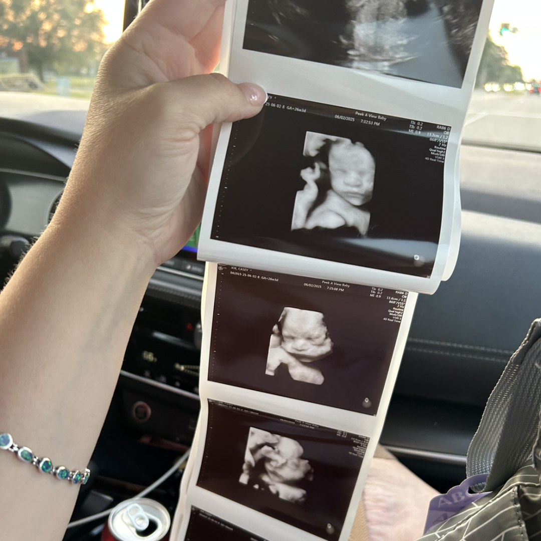 Photo shared by Casey for their Babylist baby registry.