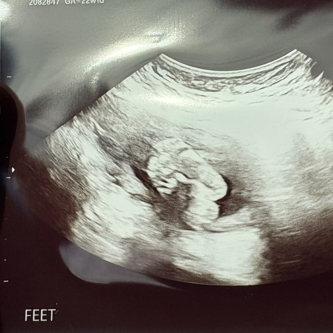 Photo shared by Alaina for their Babylist baby registry.