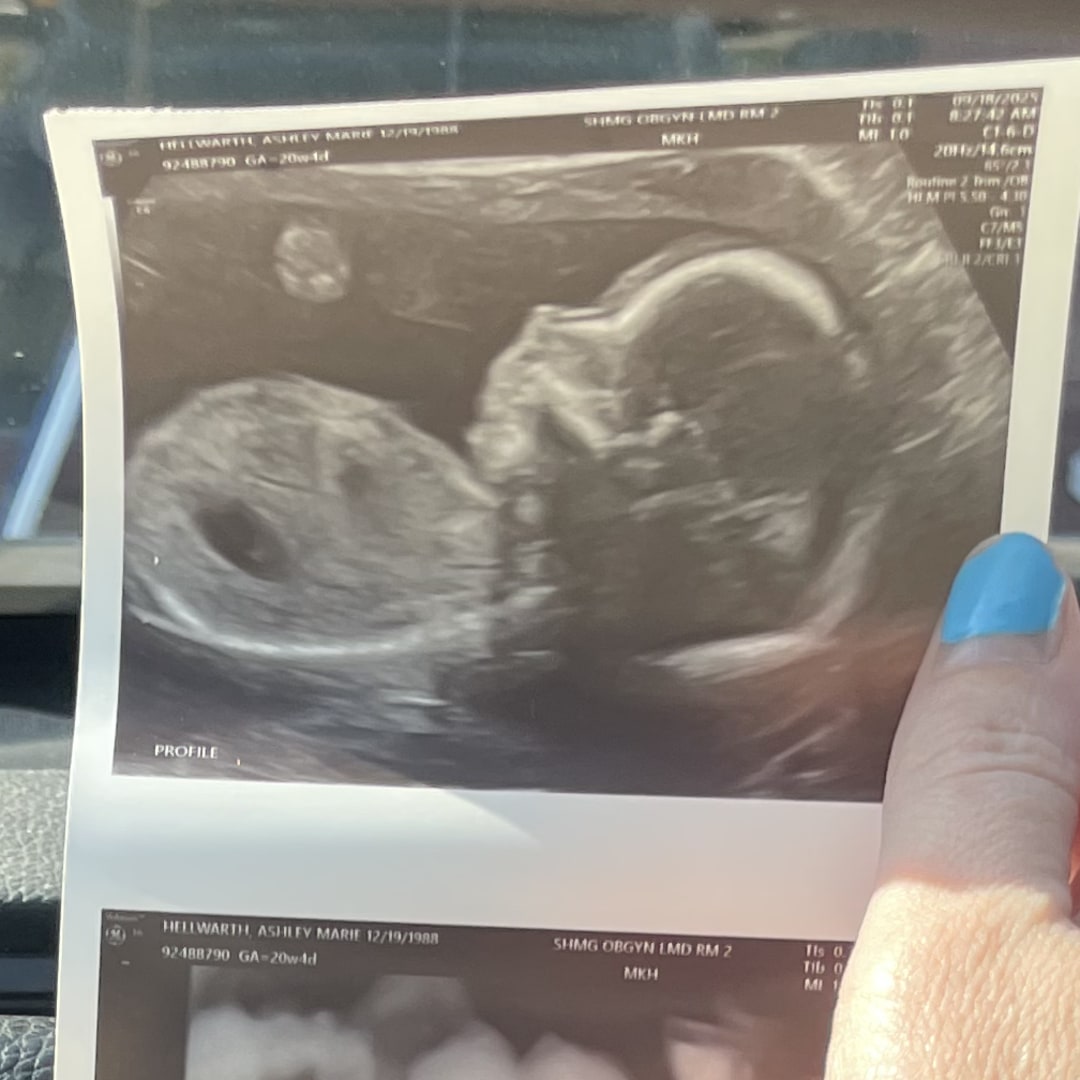 Photo shared by Ashley for their Babylist baby registry.