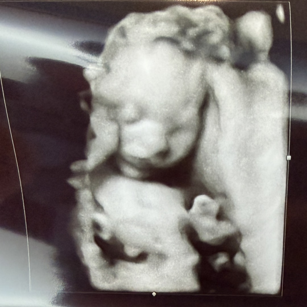 Photo shared by Bria for their Babylist baby registry.