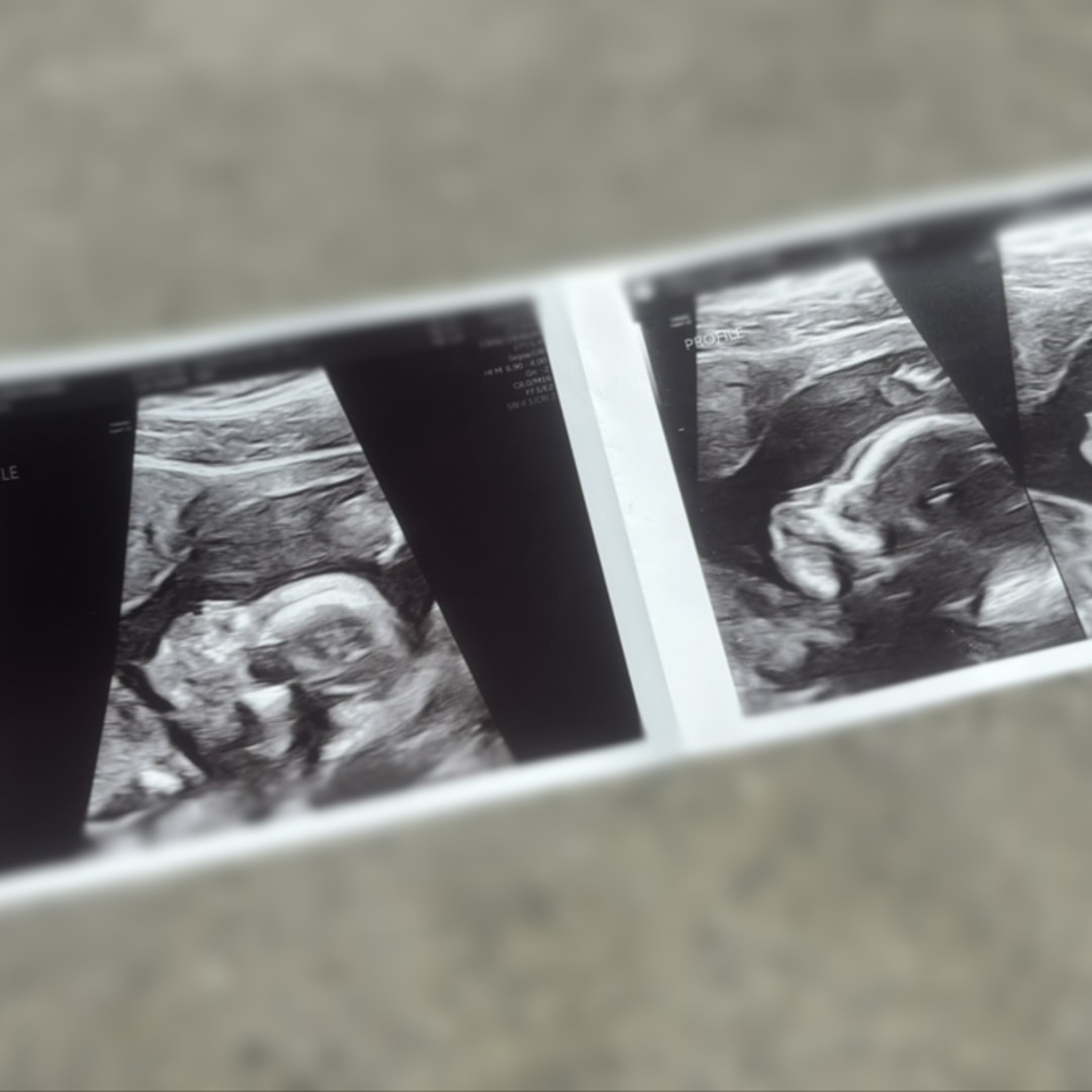 Photo shared by Jo-Anna for their Babylist baby registry.