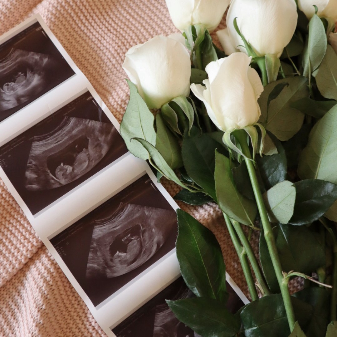 Photo shared by Shaylynn for their Babylist baby registry.