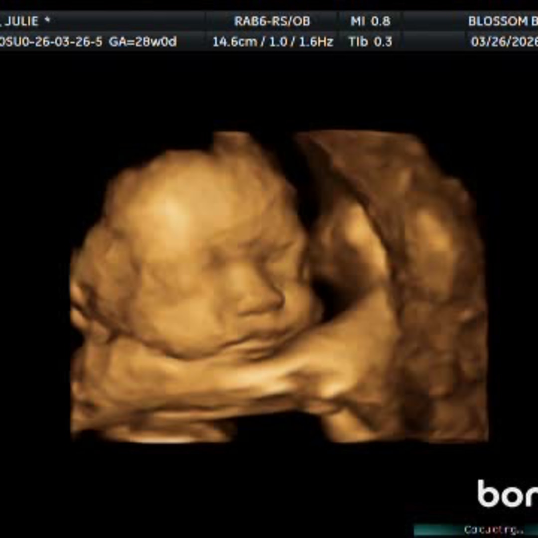 Photo shared by Julie for their Babylist baby registry.