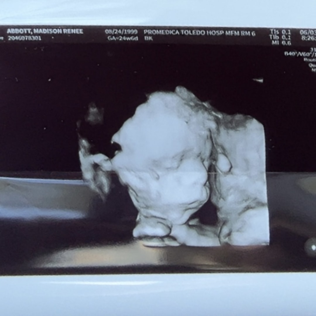 Photo shared by Madison for their Babylist baby registry.