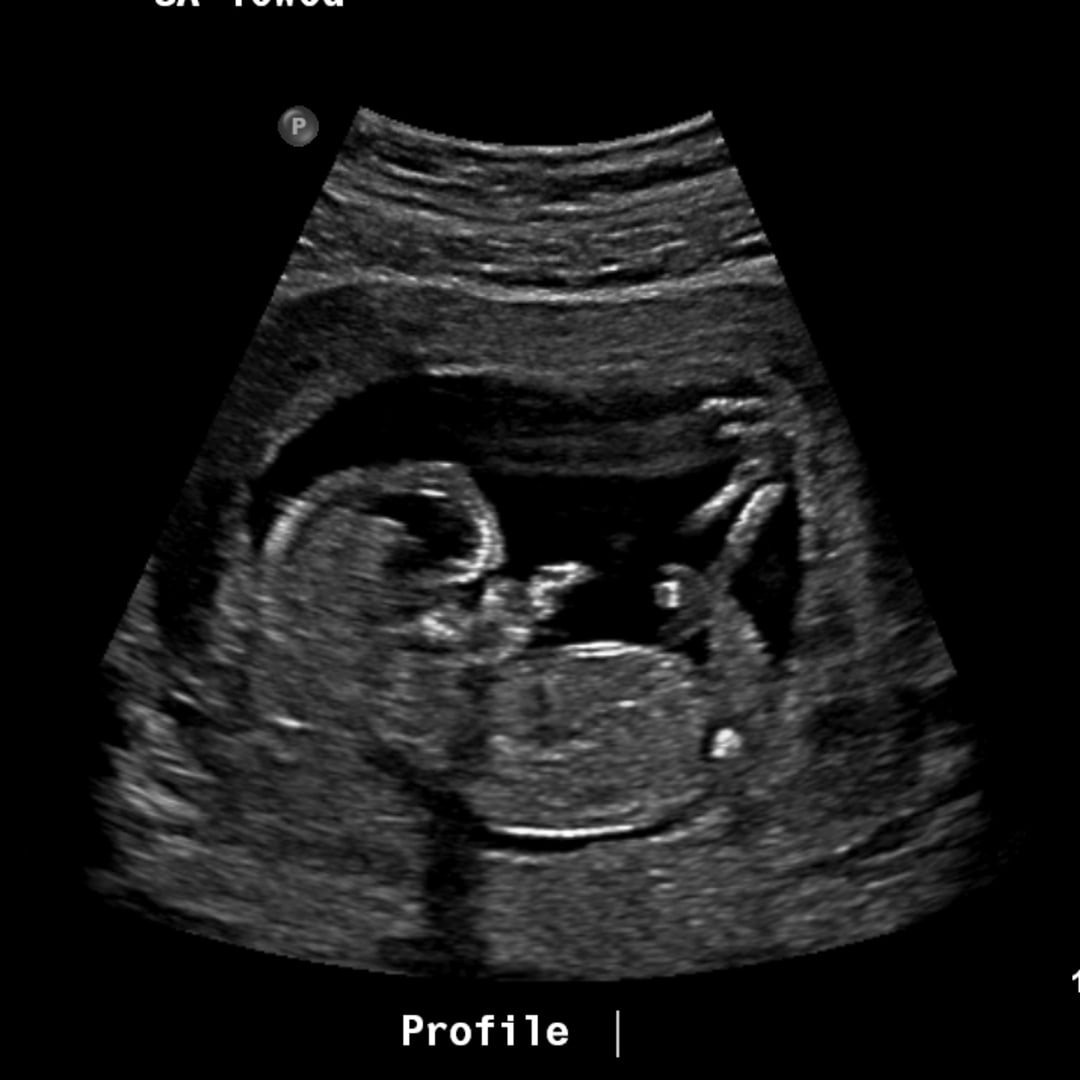Photo shared by Julia for their Babylist baby registry.