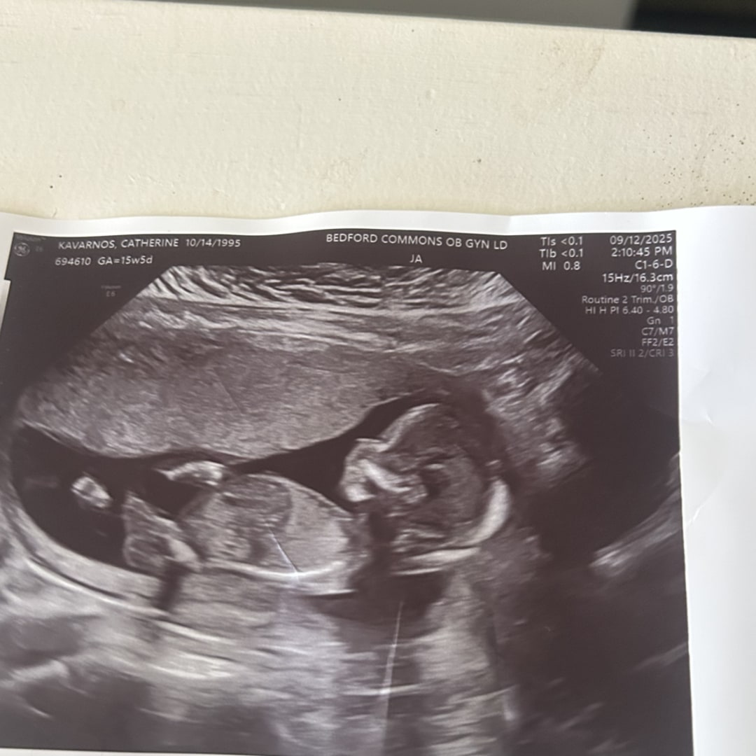 Photo shared by Catherine for their Babylist baby registry.