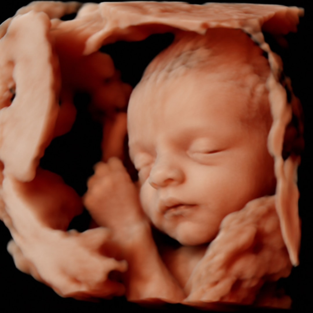 Photo shared by Halle for their Babylist baby registry.
