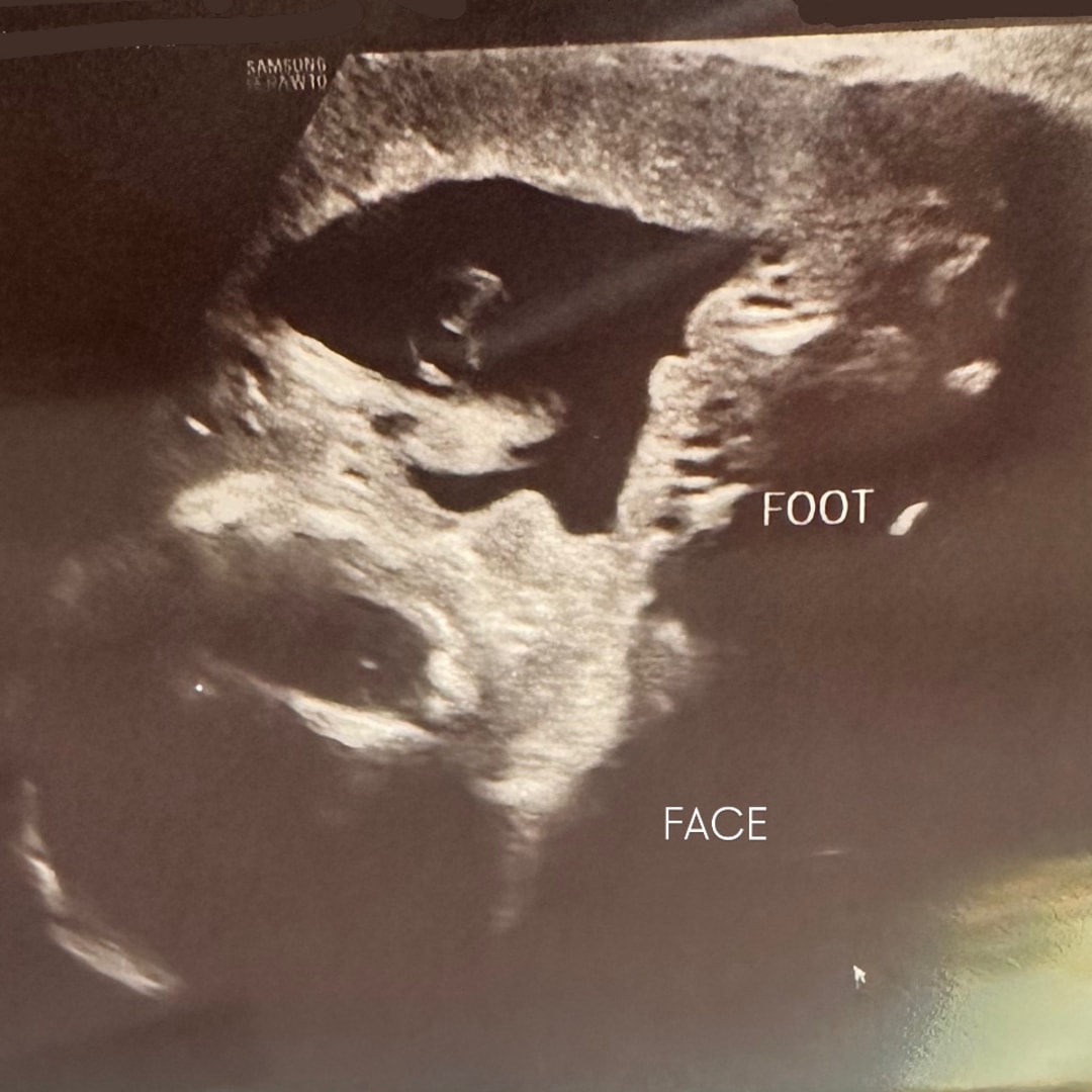 Photo shared by Alana Kendall for their Babylist baby registry.