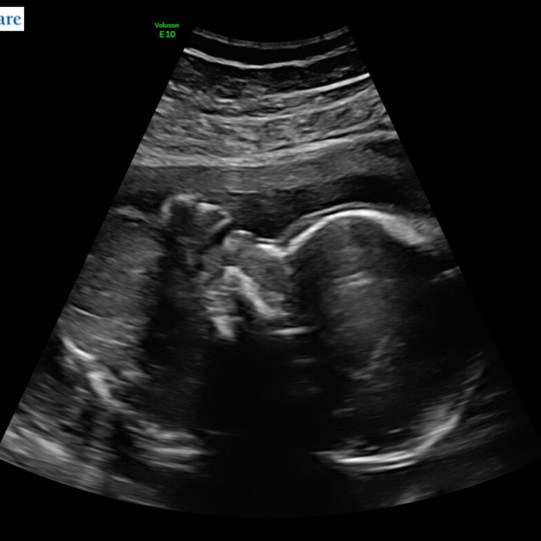 Photo shared by Allie for their Babylist baby registry.
