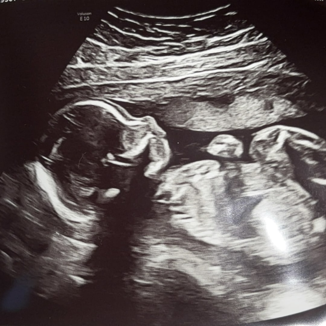 Photo shared by Emma for their Babylist baby registry.
