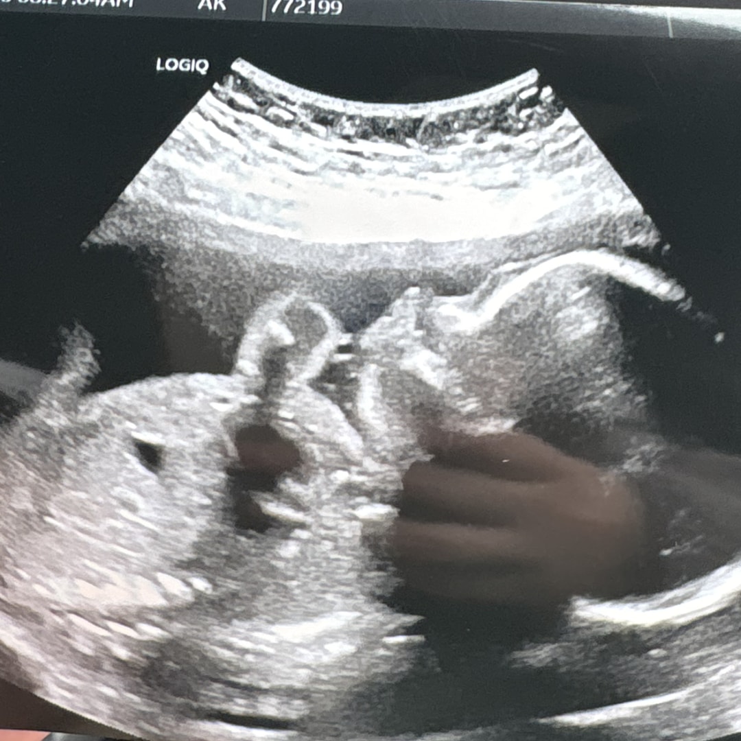 Photo shared by Leah for their Babylist baby registry.