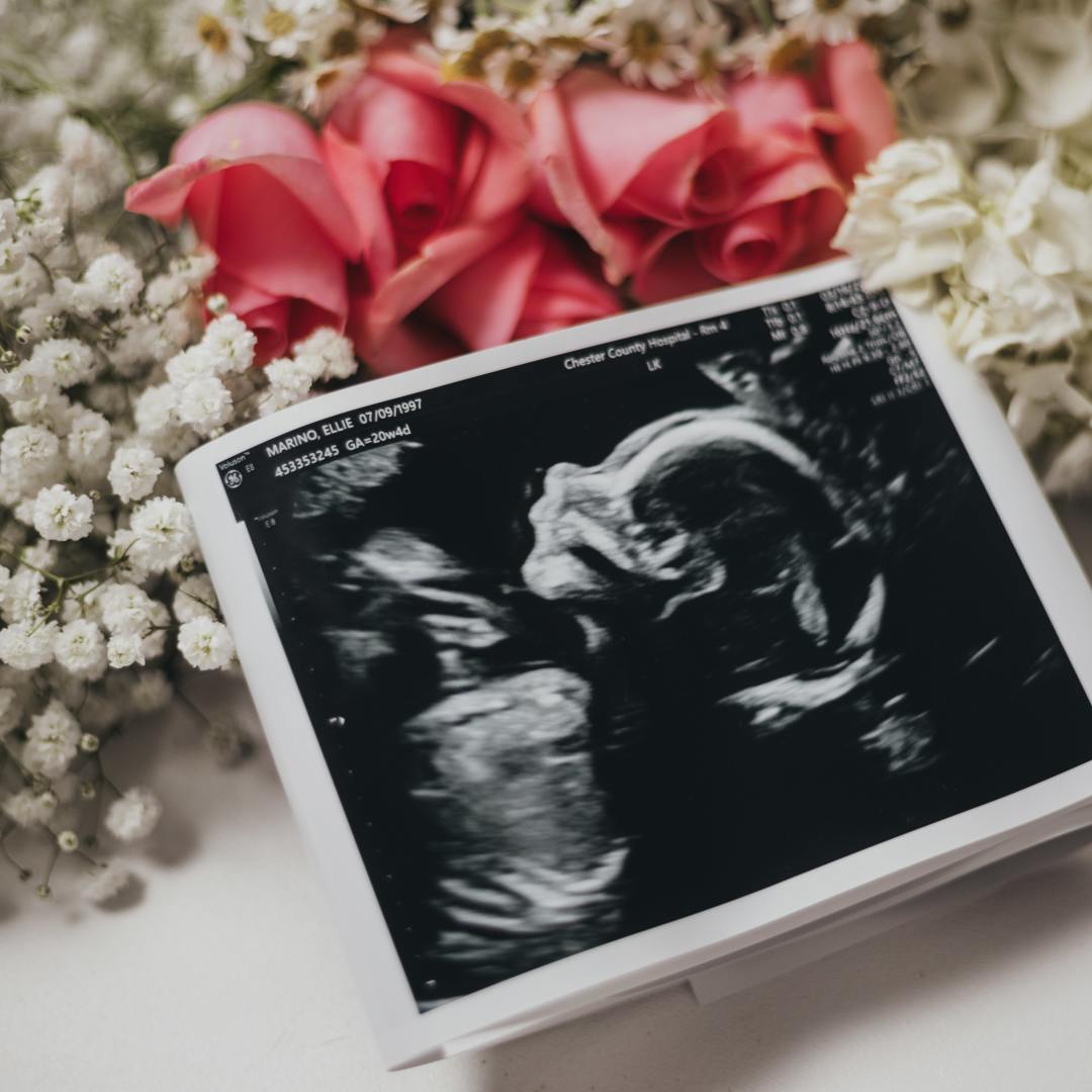 Photo shared by Ellie for their Babylist baby registry.