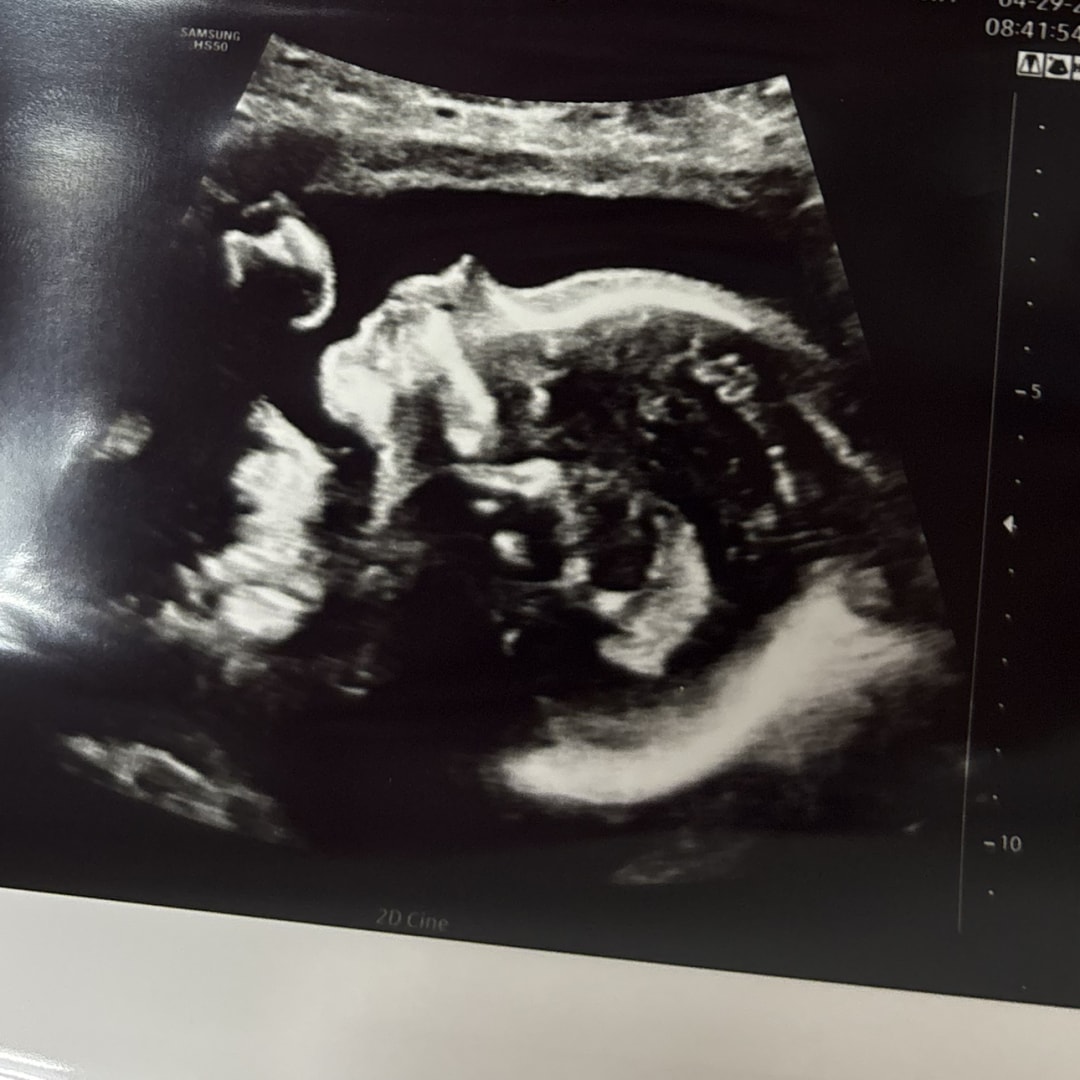 Photo shared by Brianna for their Babylist baby registry.
