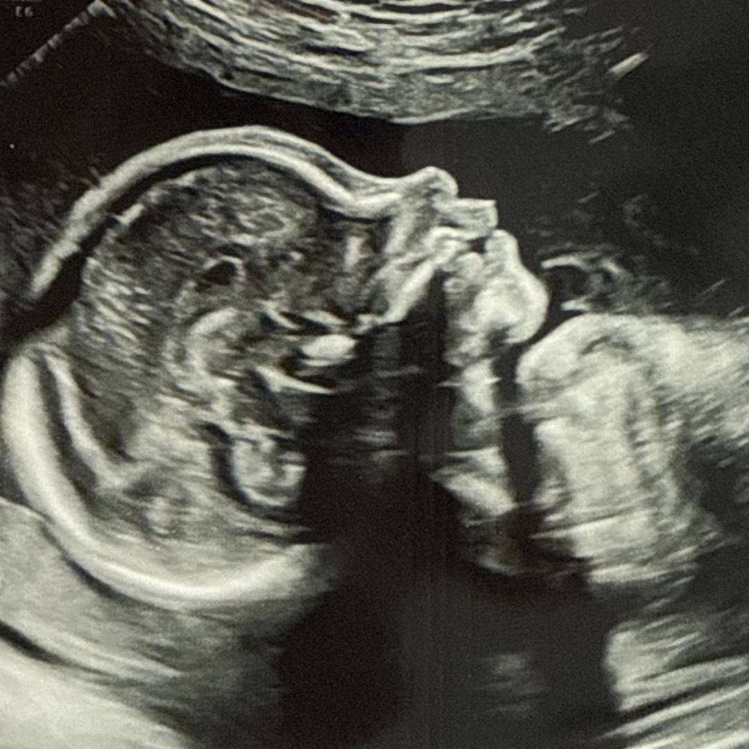 Photo shared by Savannah for their Babylist baby registry.