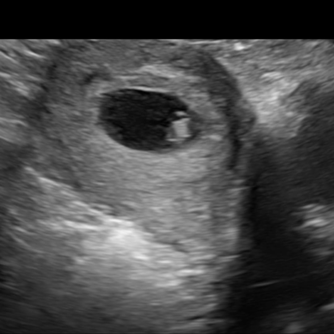 Photo shared by Gabe & Leslie for their Babylist baby registry.