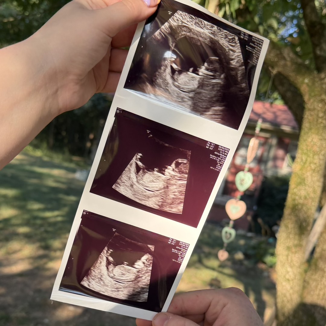 Photo shared by Savannah for their Babylist baby registry.