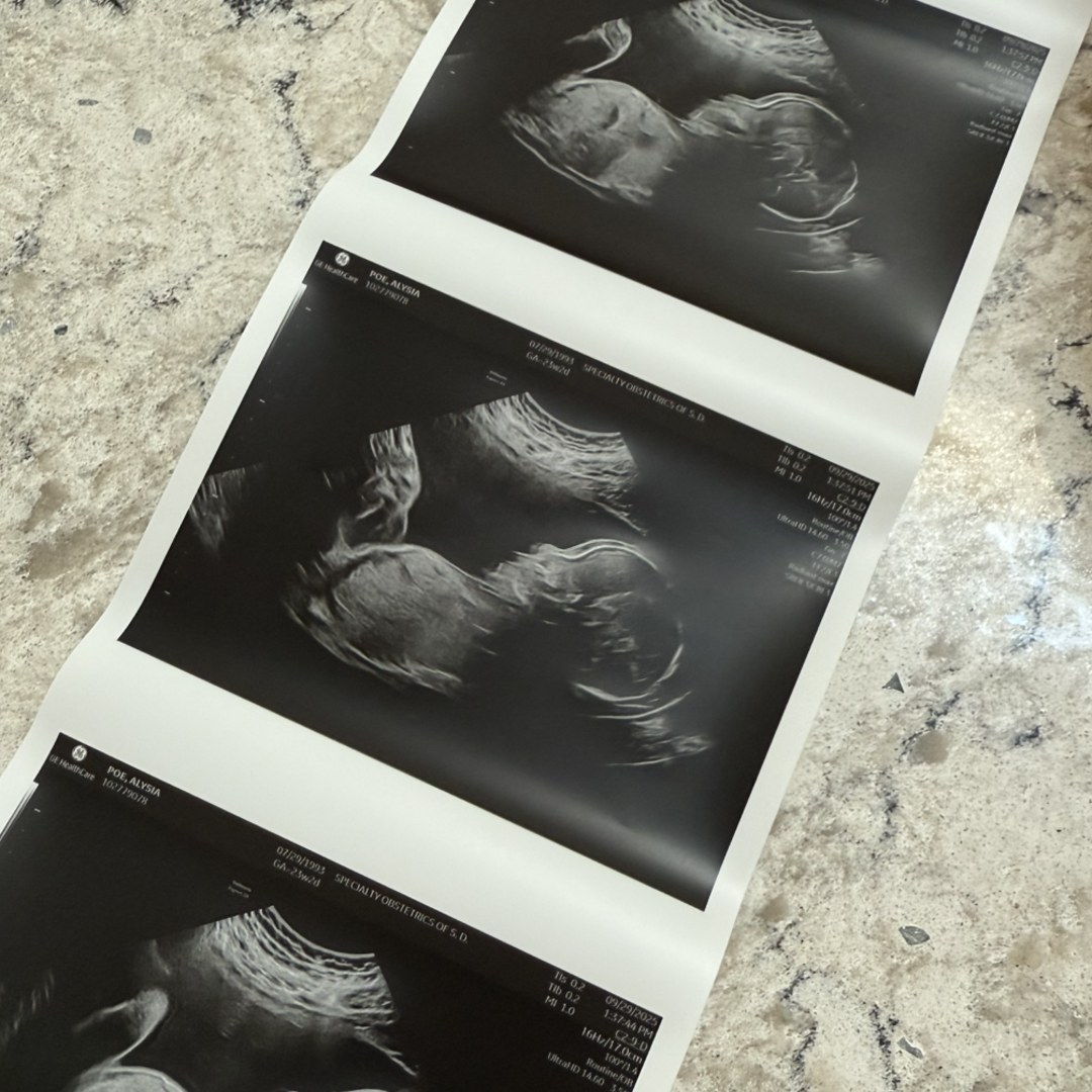 Photo shared by Alysia for their Babylist baby registry.