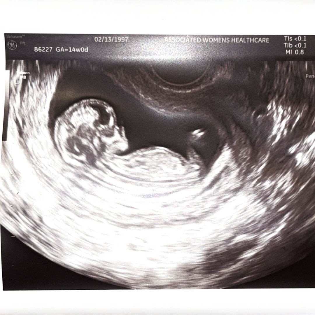 Photo shared by Brooke for their Babylist baby registry.