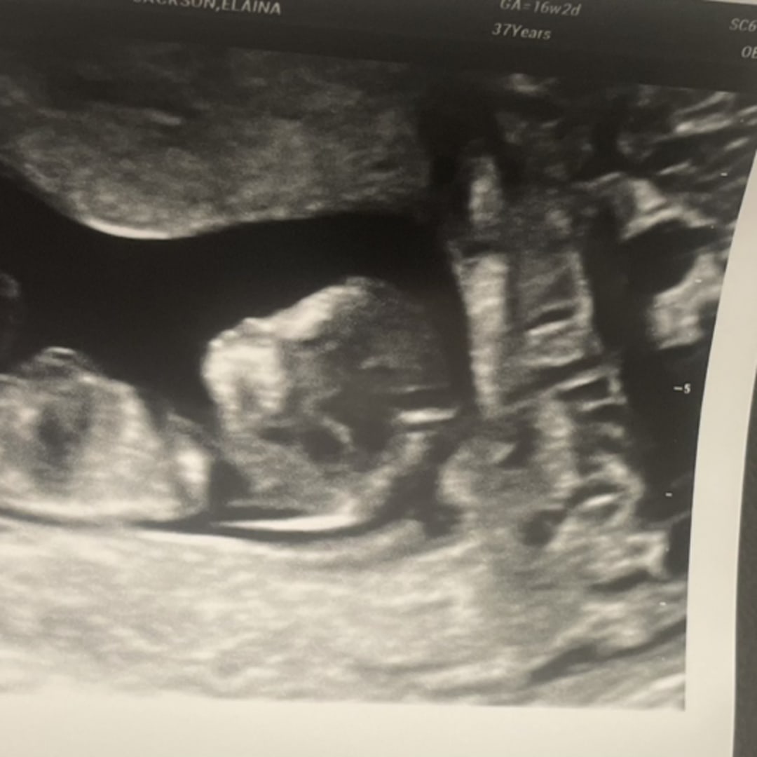 Photo shared by Elaina for their Babylist baby registry.