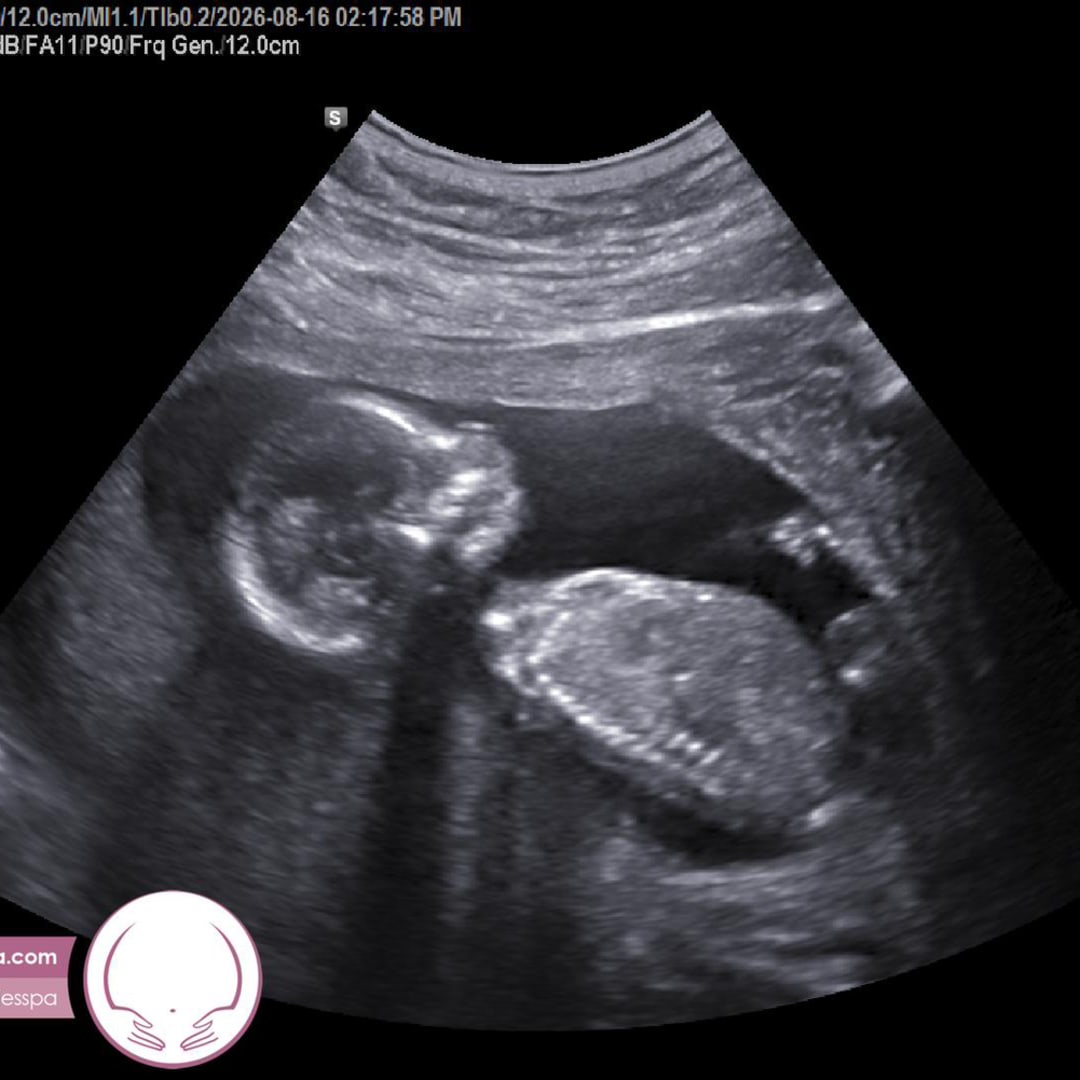 Photo shared by Hillary for their Babylist baby registry.