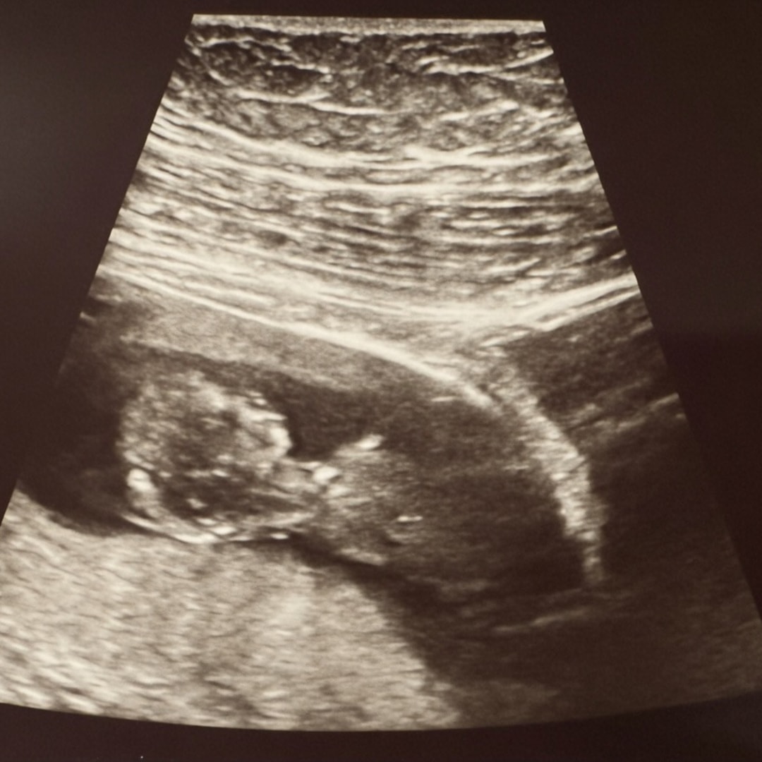 Photo shared by Morgan for their Babylist baby registry.