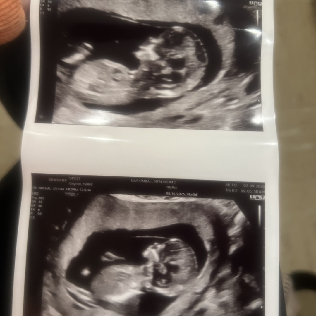 Photo shared by Hailey for their Babylist baby registry.