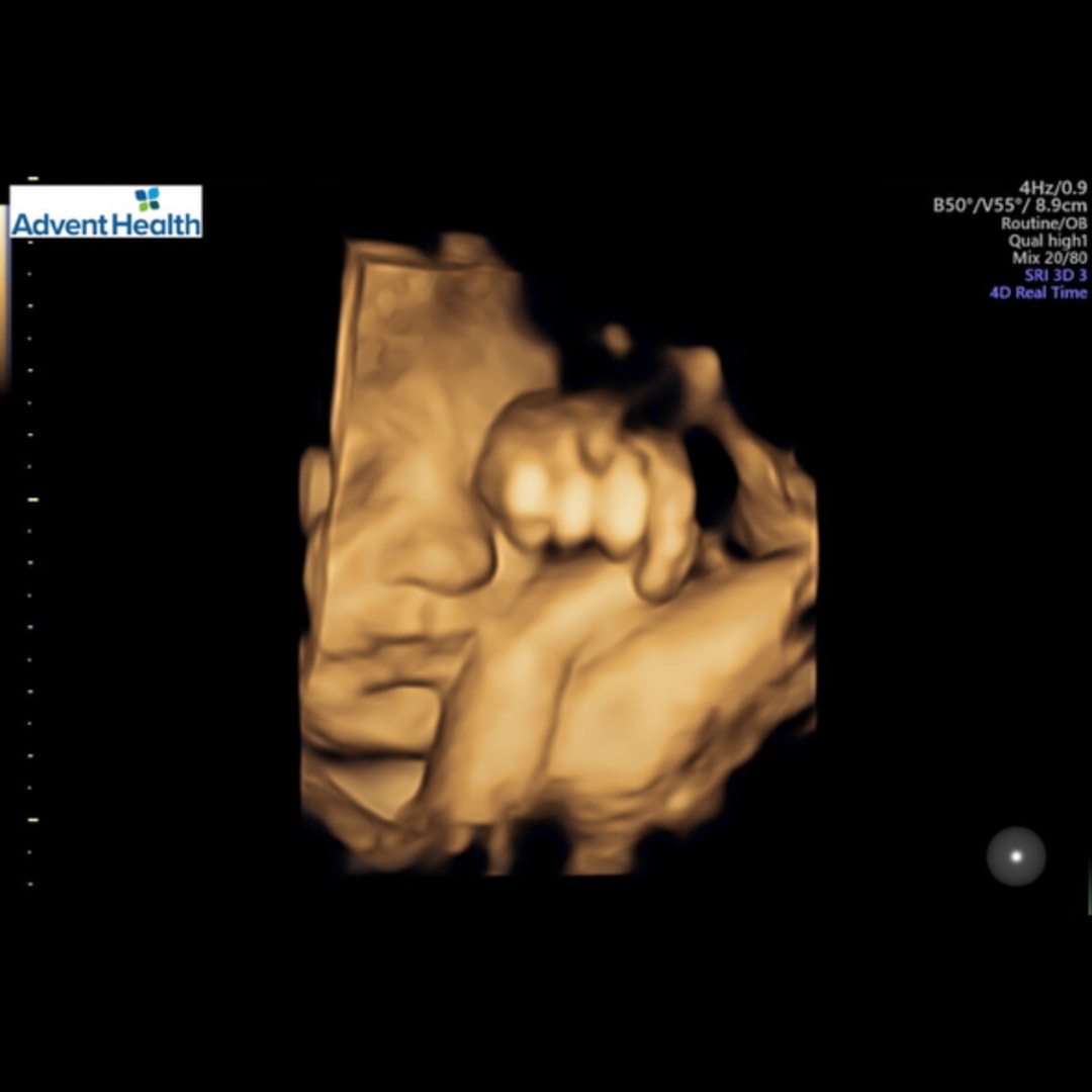 Photo shared by Lindsey for their Babylist baby registry.