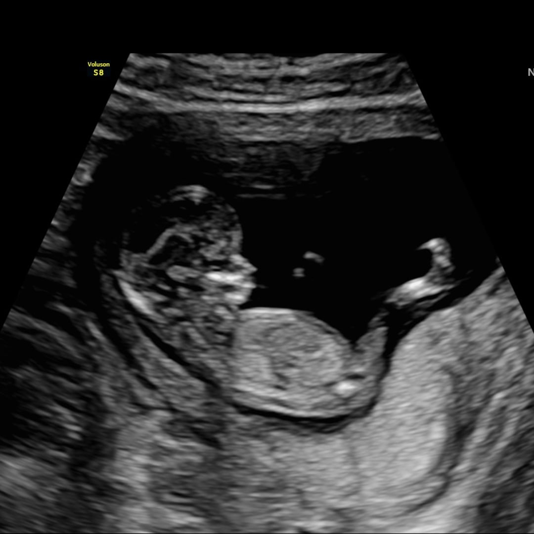 Photo shared by Rebecca for their Babylist baby registry.