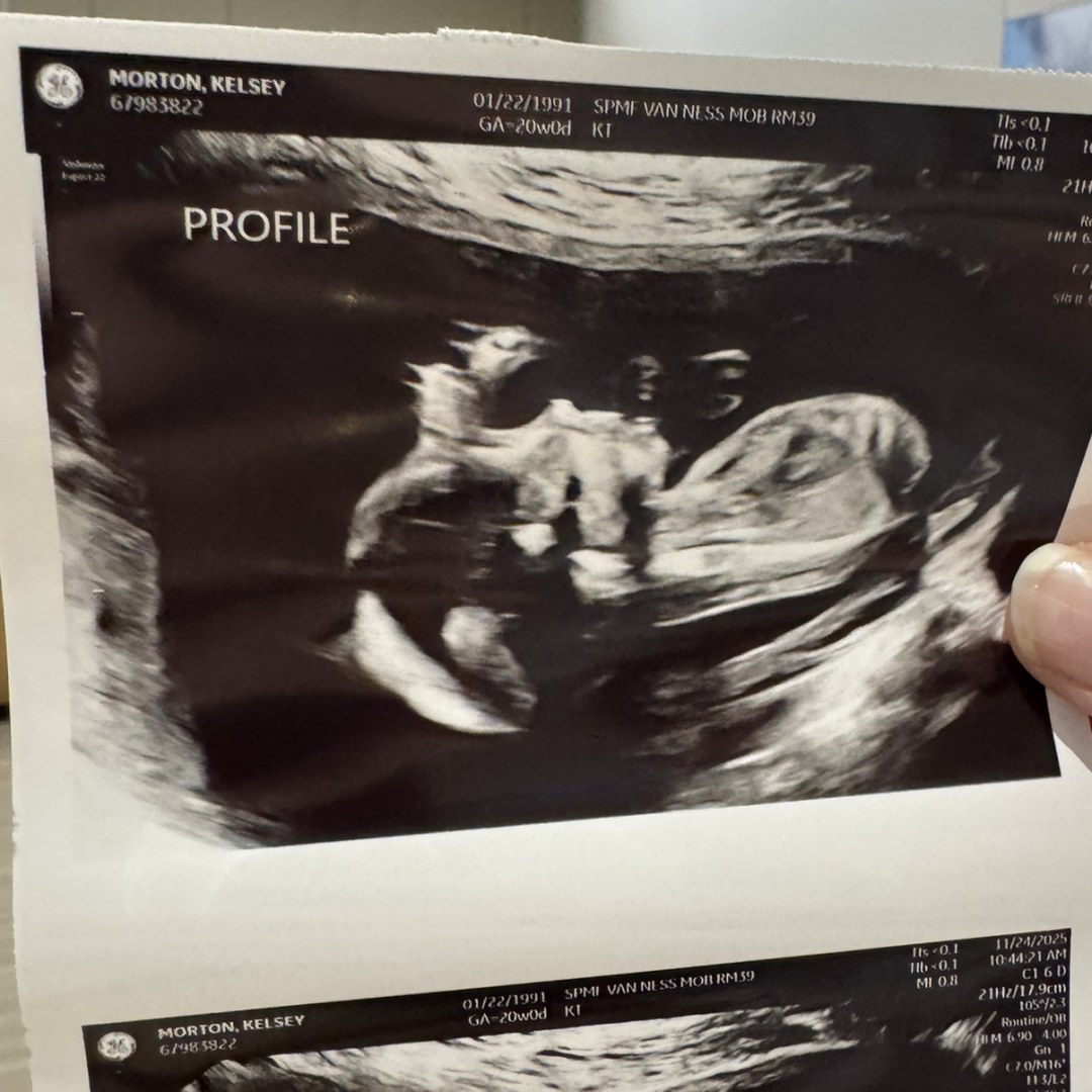 Photo shared by Kelsey for their Babylist baby registry.