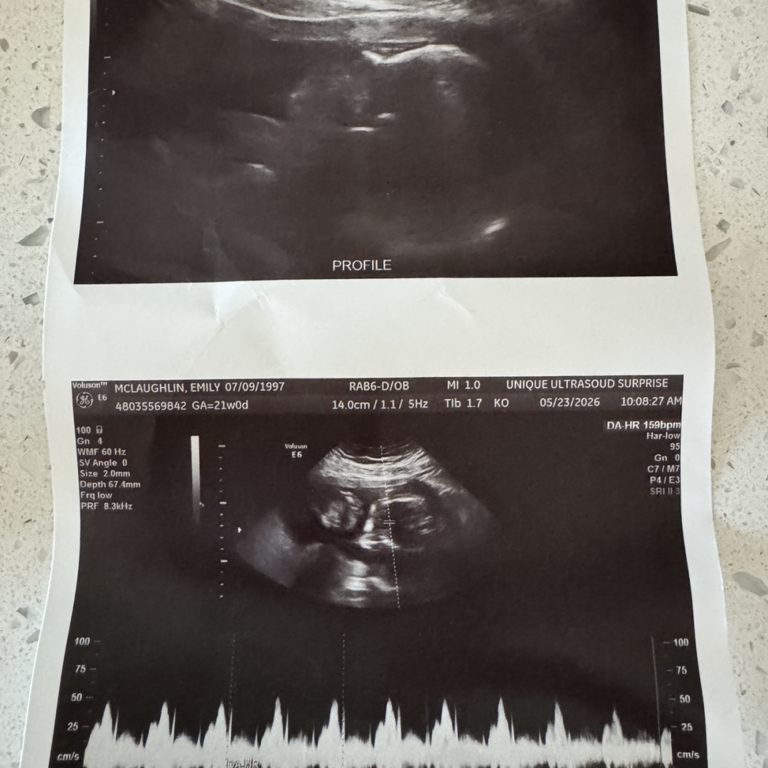 Photo shared by Emily for their Babylist baby registry.