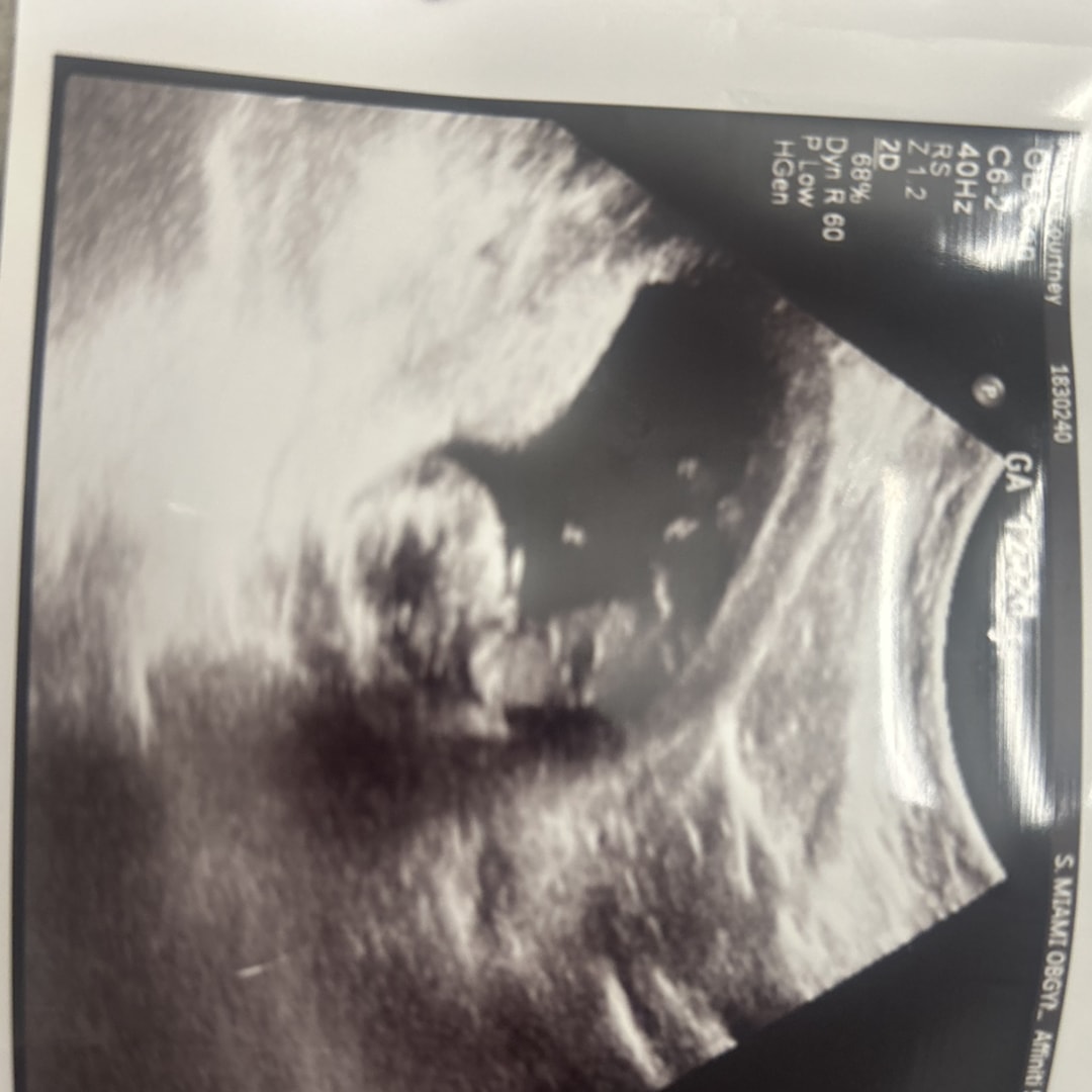 Photo shared by Courtney for their Babylist baby registry.