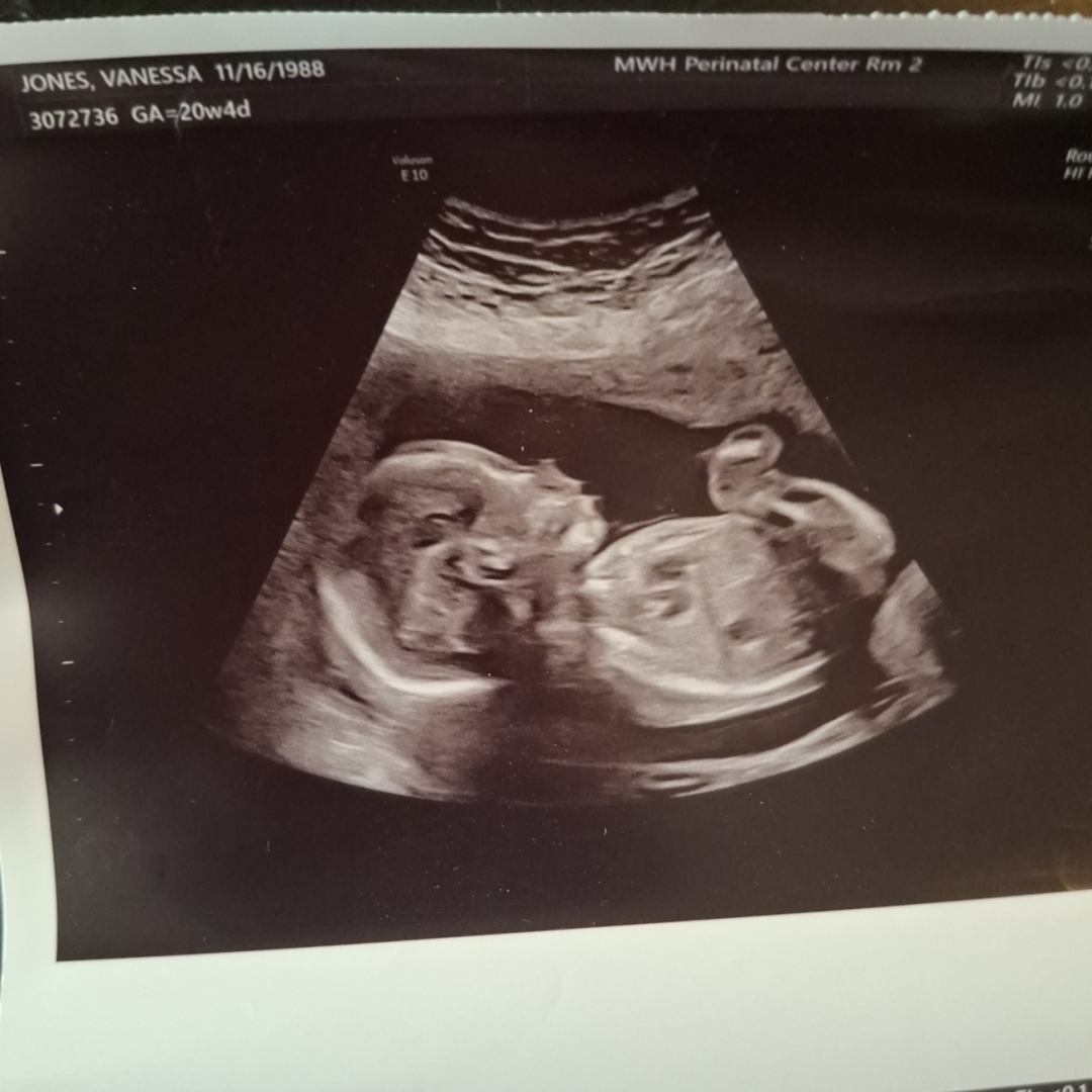 Photo shared by Eric for their Babylist baby registry.